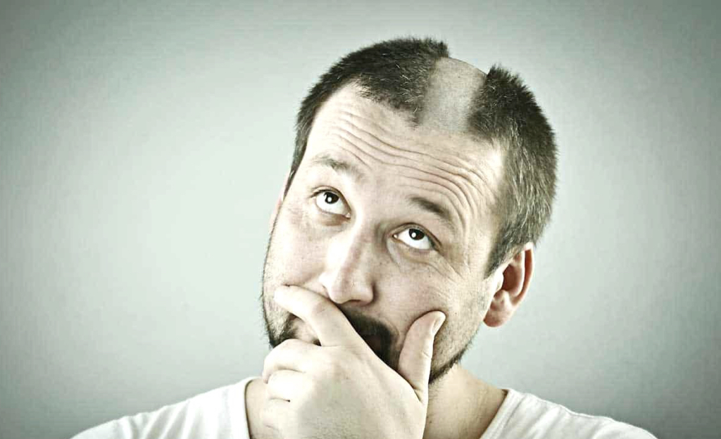 زراعة الشعر بدون حلاقة في تركيا